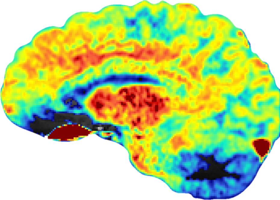 Midsagittal glutamate-weighted CEST map of the human brain at 7 Tesla, colored from blue (low) to red (high GluCEST contrast)